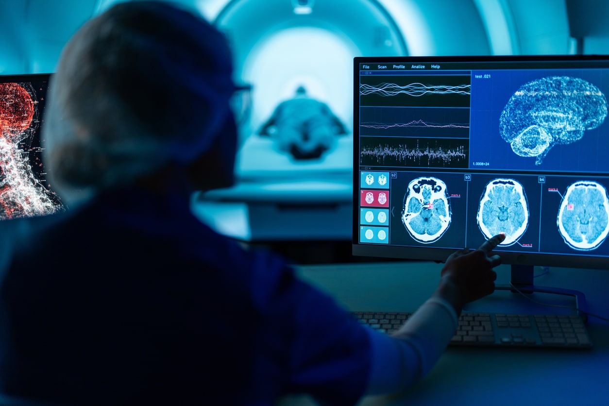Tout comprendre à l’accident ischémique transitoire