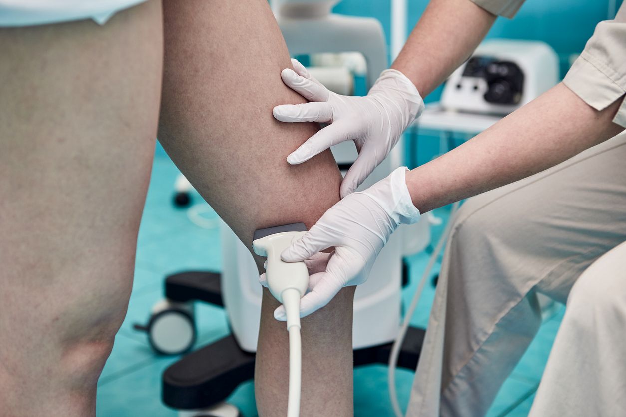 Jambes lourdes, varices… quand consulter un phlébologue ?